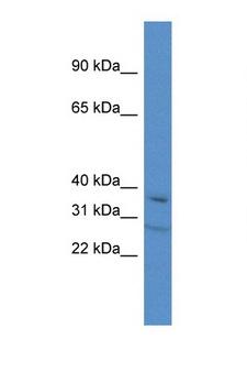TCEA3 Antibody - TCEA3 antibody Western blot of Mouse Thymus lysate. Antibody concentration 1 ug/ml.  This image was taken for the unconjugated form of this product. Other forms have not been tested.