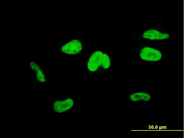 TCEA3 Antibody - Immunofluorescence of monoclonal antibody to TCEA3 on HepG2 cell. [antibody concentration 10 ug/ml]
