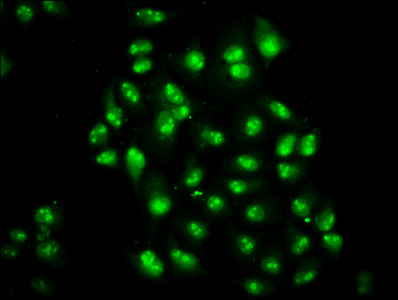 TCEA3 Antibody - Immunofluorescence staining of Hela cells diluted at 1:200, counter-stained with DAPI. The cells were fixed in 4% formaldehyde, permeabilized using 0.2% Triton X-100 and blocked in 10% normal Goat Serum. The cells were then incubated with the antibody overnight at 4°C.The Secondary antibody was Alexa Fluor 488-congugated AffiniPure Goat Anti-Rabbit IgG (H+L).