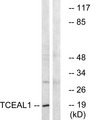 TCEAL1 Antibody - Western blot analysis of lysates from COLO cells, using TCEAL1 Antibody. The lane on the right is blocked with the synthesized peptide.