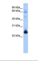 TCEAL1 Antibody - Fetal muscle lysate. Antibody concentration: 1.0 ug/ml. Gel concentration: 12%.  This image was taken for the unconjugated form of this product. Other forms have not been tested.