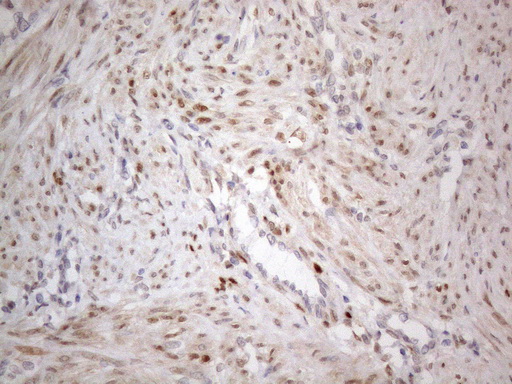 TCEAL1 Antibody - Immunohistochemical staining of paraffin-embedded Human endometrium tissue within the normal limits using anti-TCEAL1 mouse monoclonal antibody. (Heat-induced epitope retrieval by 1mM EDTA in 10mM Tris buffer. (pH8.5) at 120°C for 3 min. (1:150)