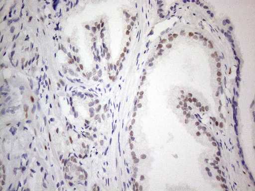 TCEAL1 Antibody - Immunohistochemical staining of paraffin-embedded Human prostate tissue within the normal limits using anti-TCEAL1 mouse monoclonal antibody. (Heat-induced epitope retrieval by 1mM EDTA in 10mM Tris buffer. (pH8.5) at 120°C for 3 min. (1:150)