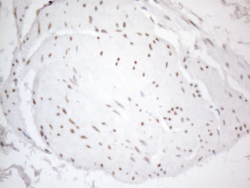 TCEAL1 Antibody - Immunohistochemical staining of paraffin-embedded Human bladder tissue within the normal limits using anti-TCEAL1 mouse monoclonal antibody. (Heat-induced epitope retrieval by 1mM EDTA in 10mM Tris buffer. (pH8.5) at 120°C for 3 min. (1:150)