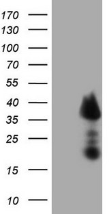 TCEAL1 Antibody - HEK293T cells were transfected with the pCMV6-ENTRY control. (Left lane) or pCMV6-ENTRY TCEAL1. (Right lane) cDNA for 48 hrs and lysed. Equivalent amounts of cell lysates. (5 ug per lane) were separated by SDS-PAGE and immunoblotted with anti-TCEAL1. (1:2000)