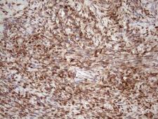 TCEAL1 Antibody - Immunohistochemical staining of paraffin-embedded Human Ovary tissue within the normal limits using anti-TCEAL1 mouse monoclonal antibody. (Heat-induced epitope retrieval by 1mM EDTA in 10mM Tris buffer. (pH8.5) at 120 oC for 3 min. (1:150)