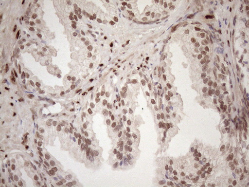 TCEAL1 Antibody - Immunohistochemical staining of paraffin-embedded Human prostate tissue within the normal limits using anti-TCEAL1 mouse monoclonal antibody. (Heat-induced epitope retrieval by 1mM EDTA in 10mM Tris buffer. (pH8.5) at 120 oC for 3 min. (1:150)