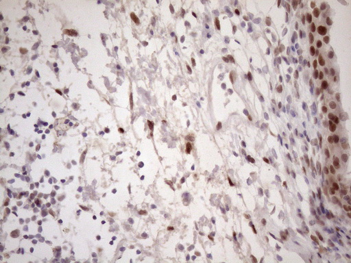TCEAL1 Antibody - Immunohistochemical staining of paraffin-embedded Human bladder tissue within the normal limits using anti-TCEAL1 mouse monoclonal antibody. (Heat-induced epitope retrieval by 1mM EDTA in 10mM Tris buffer. (pH8.5) at 120 oC for 3 min. (1:150)