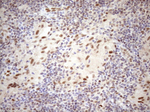 TCEAL1 Antibody - Immunohistochemical staining of paraffin-embedded Human lymph node tissue within the normal limits using anti-TCEAL1 mouse monoclonal antibody. (Heat-induced epitope retrieval by 1mM EDTA in 10mM Tris buffer. (pH8.5) at 120 oC for 3 min. (1:150)
