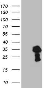 TCEAL1 Antibody - HEK293T cells were transfected with the pCMV6-ENTRY control. (Left lane) or pCMV6-ENTRY TCEAL1. (Right lane) cDNA for 48 hrs and lysed. Equivalent amounts of cell lysates. (5 ug per lane) were separated by SDS-PAGE and immunoblotted with anti-TCEAL1. (1:2000)