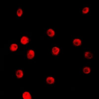 TCEAL1 Antibody - Immunofluorescent analysis of TCEAL1 staining in HepG2 cells. Formalin-fixed cells were permeabilized with 0.1% Triton X-100 in TBS for 5-10 minutes and blocked with 3% BSA-PBS for 30 minutes at room temperature. Cells were probed with the primary antibody in 3% BSA-PBS and incubated overnight at 4 deg C in a humidified chamber. Cells were washed with PBST and incubated with a DyLight 594-conjugated secondary antibody (red) in PBS at room temperature in the dark. DAPI was used to stain the cell nuclei (blue).