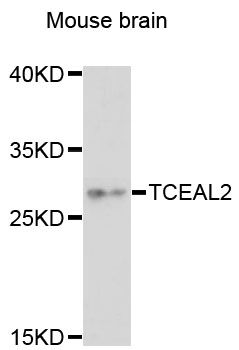 TCEAL2 Antibody - Western blot analysis of extracts of mouse brain, using TCEAL2 antibody at 1:3000 dilution. The secondary antibody used was an HRP Goat Anti-Rabbit IgG (H+L) at 1:10000 dilution. Lysates were loaded 25ug per lane and 3% nonfat dry milk in TBST was used for blocking. An ECL Kit was used for detection and the exposure time was 90s.