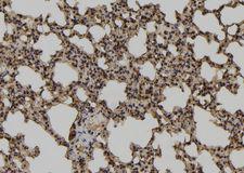 TCEAL2 Antibody - 1:100 staining mouse lung tissue by IHC-P. The sample was formaldehyde fixed and a heat mediated antigen retrieval step in citrate buffer was performed. The sample was then blocked and incubated with the antibody for 1.5 hours at 22°C. An HRP conjugated goat anti-rabbit antibody was used as the secondary.
