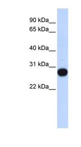 TCEAL4 Antibody - TCEAL4 antibody Western blot of Fetal Muscle lysate. This image was taken for the unconjugated form of this product. Other forms have not been tested.