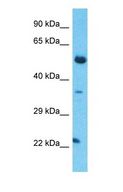 TCEAL5 Antibody - Western blot of TCEAL5 Antibody with human Thymus Tumor lysate.  This image was taken for the unconjugated form of this product. Other forms have not been tested.