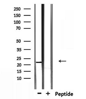 TCEAL5 Antibody - Western blot analysis of extracts of mouse brain tissue using TCEAL5 antibody.