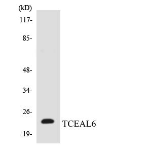 TCEAL6 Antibody - Western blot analysis of the lysates from HUVECcells using TCEAL6 antibody.