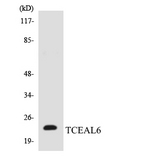 TCEAL6 Antibody - Western blot analysis of the lysates from HUVECcells using TCEAL6 antibody.