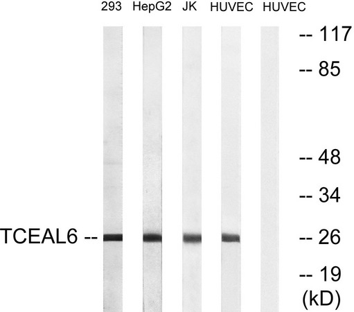 TCEAL6 Antibody - Western blot analysis of lysates from HUVEC, 293, HepG2, and Jurkat cells, using TCEAL6 Antibody. The lane on the right is blocked with the synthesized peptide.