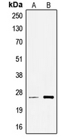 TCEAL6 Antibody - Western blot analysis of TCEAL6 expression in A549 (A); Jurkat (B) whole cell lysates.