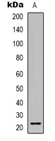 TCEAL6 Antibody - Western blot analysis of TCEAL6 expression in COLO205 (A) whole cell lysates.