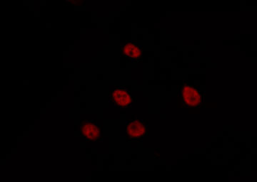 TCEAL6 Antibody - Staining HepG2 cells by IF/ICC. The samples were fixed with PFA and permeabilized in 0.1% Triton X-100, then blocked in 10% serum for 45 min at 25°C. The primary antibody was diluted at 1:200 and incubated with the sample for 1 hour at 37°C. An Alexa Fluor 594 conjugated goat anti-rabbit IgG (H+L) Ab, diluted at 1/600, was used as the secondary antibody.