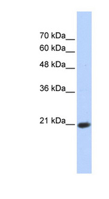 TCEAL8 Antibody - TCEAL8 antibody Western blot of Transfected 293T cell lysate. This image was taken for the unconjugated form of this product. Other forms have not been tested.