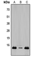 TCEAL8 Antibody - Western blot analysis of TCEAL8 expression in HeLa (A); Raw264.7 (B); PC12 (C) whole cell lysates.