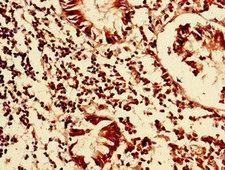 TCEAL8 Antibody - Immunohistochemistry of paraffin-embedded human appendix tissue using TCEAL8 Antibody at dilution of 1:100