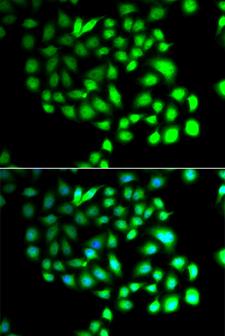 TCEAL8 Antibody - Immunofluorescence analysis of A549 cells using TCEAL8 Polyclonal Antibody.