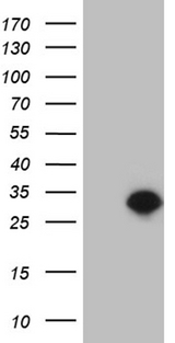 TCEANC2 Antibody - HEK293T cells were transfected with the pCMV6-ENTRY control. (Left lane) or pCMV6-ENTRY TCEANC2. (Right lane) cDNA for 48 hrs and lysed. Equivalent amounts of cell lysates. (5 ug per lane) were separated by SDS-PAGE and immunoblotted with anti-TCEANC2. (1:2000)