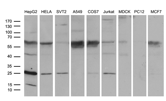 TCEANC2 Antibody - Western blot analysis of extracts. (35ug) from 9 different cell lines by using anti-TCEANC2 monoclonal antibody. (HepG2: human; HeLa: human; SVT2: mouse; A549: human; COS7: monkey; Jurkat: human; MDCK: canine;rat; MCF7: human). (1:500)