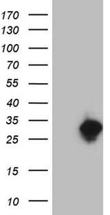 TCEANC2 Antibody - HEK293T cells were transfected with the pCMV6-ENTRY control. (Left lane) or pCMV6-ENTRY TCEANC2. (Right lane) cDNA for 48 hrs and lysed. Equivalent amounts of cell lysates. (5 ug per lane) were separated by SDS-PAGE and immunoblotted with anti-TCEANC2. (1:2000)