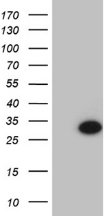 TCEANC2 Antibody - HEK293T cells were transfected with the pCMV6-ENTRY control. (Left lane) or pCMV6-ENTRY TCEANC2. (Right lane) cDNA for 48 hrs and lysed