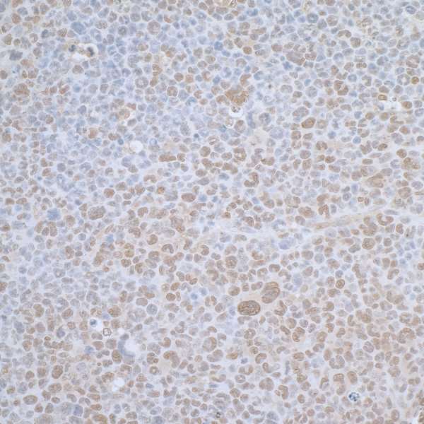 TCEB1 / Elongin C Antibody - Detection of mouse TCEB1 by immunohistochemistry. Sample: FFPE section of mouse plasmacytoma. Antibody: Affinity purified rabbit anti-TCEB1 used at a dilution of 1:1,000 (1µg/ml). Detection: DAB