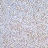 TCEB1 / Elongin C Antibody - Detection of mouse TCEB1 by immunohistochemistry. Sample: FFPE section of mouse plasmacytoma. Antibody: Affinity purified rabbit anti-TCEB1 used at a dilution of 1:1,000 (1µg/ml). Detection: DAB