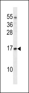 TCEB1 / Elongin C Antibody - TCEB1 Antibody western blot of Jurkat cell line lysates (35 ug/lane). The TCEB1 antibody detected the TCEB1 protein (arrow).