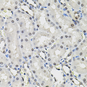 TCEB1 / Elongin C Antibody - Immunohistochemistry of paraffin-embedded rat kidney tissue.