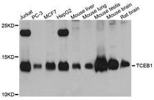 TCEB1 / Elongin C Antibody - Western blot analysis of extracts of various cell lines, using TCEB1 antibody at 1:1000 dilution. The secondary antibody used was an HRP Goat Anti-Rabbit IgG (H+L) at 1:10000 dilution. Lysates were loaded 25ug per lane and 3% nonfat dry milk in TBST was used for blocking. An ECL Kit was used for detection and the exposure time was 60s.