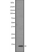 TCEB1 / Elongin C Antibody - Western blot analysis of TCEB1 expression in Jurkat cells line lysates. The lane on the left is treated with the antigen-specific peptide.