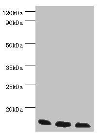 TCEB2 / Elongin B Antibody - Western blot All lanes: Transcription elongation factor B polypeptide 2 antibody at 3µg/ml Lane 1: k562 whole cell lysate Lane 2: 293T whole cell lysate Lane 3: HL60 whole cell lysate Secondary Goat polyclonal to rabbit IgG at 1/10000 dilution Predicted band size: 14, 18 kDa Observed band size: 14 kDa