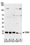TCEB2 / Elongin B Antibody - Detection of Human and Mouse TCEB2 by Western Blot. Samples: Whole cell lysate (50 ug) from Jurkat, 293T, HeLa, mouse TCMK-1, and mouse NIH3T3 cells. Antibodies: Affinity purified rabbit anti-TCEB2 antibody used for WB at 1 ug/ml. Detection: Chemiluminescence with an exposure time of 3 minutes.