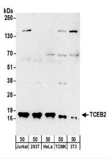 TCEB2 / Elongin B Antibody - Detection of Human and Mouse TCEB2 by Western Blot. Samples: Whole cell lysate (50 ug) from Jurkat, 293T, HeLa, mouse TCMK-1, and mouse NIH3T3 cells. Antibodies: Affinity purified rabbit anti-TCEB2 antibody used for WB at 1 ug/ml. Detection: Chemiluminescence with an exposure time of 3 minutes.