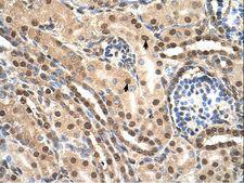 TCEB2 / Elongin B Antibody - TCEB2 antibody TCEB2(transcription elongation factor B (SIII), polypeptide 2 (18kDa, elongin B)) Antibody was used in IHC to stain formalin-fixed, paraffin-embedded human kidney.  This image was taken for the unconjugated form of this product. Other forms have not been tested.