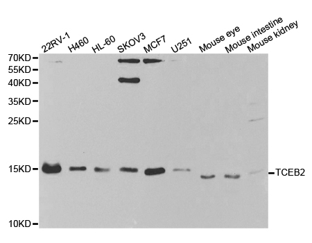 TCEB2 / Elongin B Antibody - Western blot analysis of extracts of various cell lines.