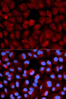 TCEB2 / Elongin B Antibody - Immunofluorescence analysis of U20S cells.