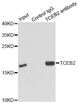 TCEB2 / Elongin B Antibody - Immunoprecipitation analysis of 150ug extracts of MCF7 cells using 3ug TCEB2 antibody. Western blot was performed from the immunoprecipitate using TCEB2 antibody at a dilition of 1:500.
