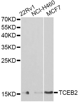 TCEB2 / Elongin B Antibody - Western blot analysis of extracts of various cell lines, using TCEB2 antibody at 1:1000 dilution. The secondary antibody used was an HRP Goat Anti-Rabbit IgG (H+L) at 1:10000 dilution. Lysates were loaded 25ug per lane and 3% nonfat dry milk in TBST was used for blocking. An ECL Kit was used for detection and the exposure time was 90s.