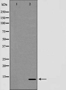 TCEB2 / Elongin B Antibody - Western blot analysis of HeLa whole cells lysates using TCEB2 antibody. The lane on the left is treated with the antigen-specific peptide.