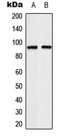 TCEB3 / Elongin A Antibody - Western blot analysis of TCEB3 expression in HeLa (A); Jurkat (B) whole cell lysates.